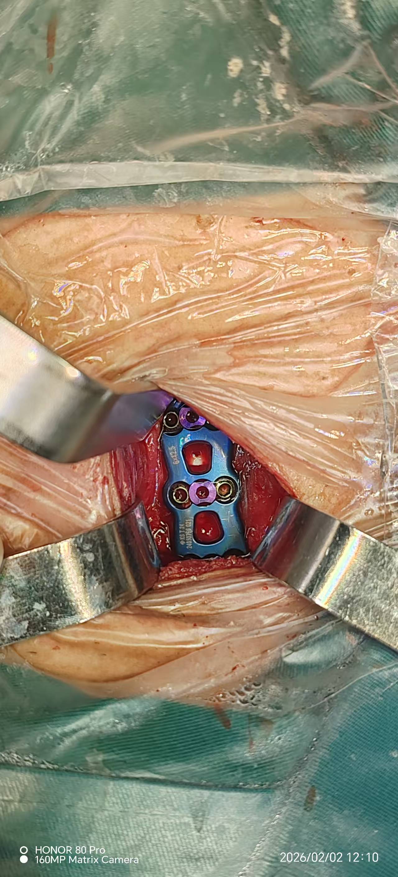 17a617f83765e22bc177d77bd590bbc