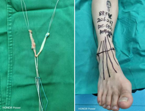 ScreenShot_2026-03-13_144947_734